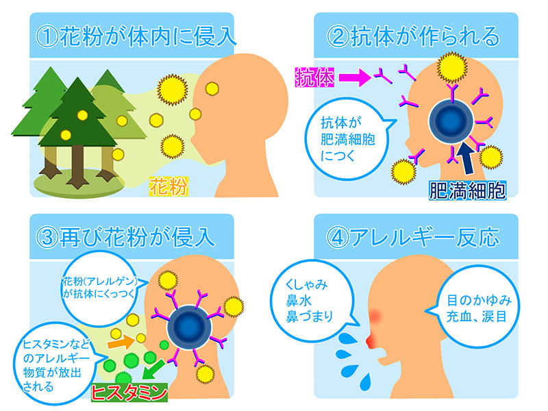 アレルギー性結膜炎の原因