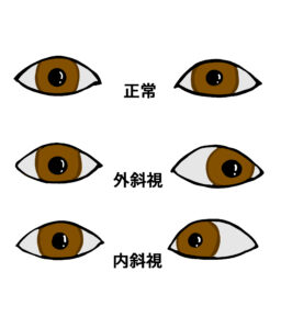 school eyecheck07