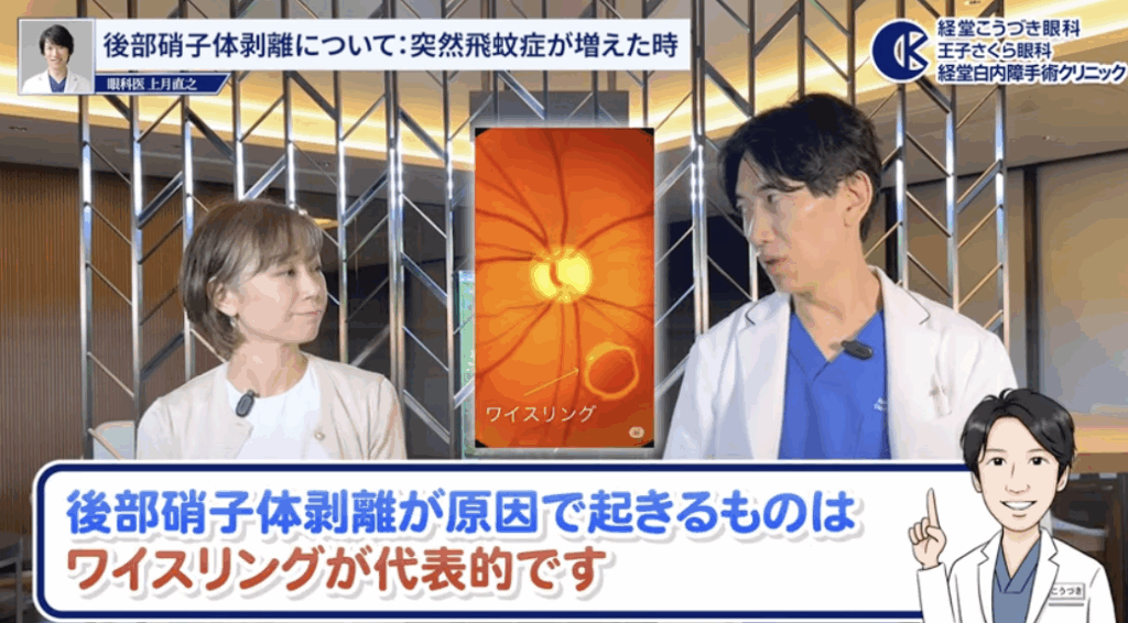ワイズリング